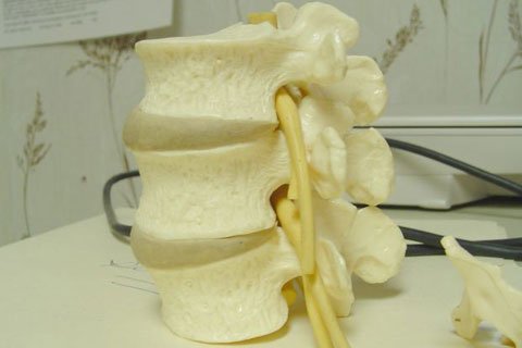 Uneven Weight On Spinal Discs Can Lead To Bulging, Herniated Or Even A Ruptured Disc.