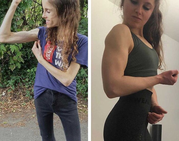 Female Athlete With “Eating Disorder” Is Now an Insanely Ripped